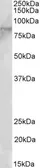 Anti-EZH1 antibody, N-term used in Western Blot (WB). GTX89888