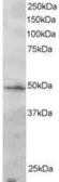 Anti-IRF2 antibody, C-term used in Western Blot (WB). GTX89898