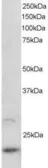 Anti-ARL2 antibody, C-term used in Western Blot (WB). GTX89899