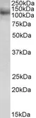 Anti-RNF31 antibody, C-term used in Western Blot (WB). GTX89901