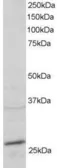 Anti-Rab11A antibody, C-term used in Western Blot (WB). GTX89906