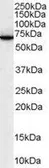 Anti-SWAP70 antibody, C-term used in Western Blot (WB). GTX89933