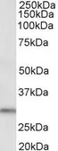 Anti-DAPP1 antibody, C-term used in Western Blot (WB). GTX89948
