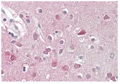 Anti-ORC3L antibody, C-term used in IHC (Paraffin sections) (IHC-P). GTX89992