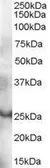 Anti-GRAP antibody, C-term used in Western Blot (WB). GTX89994